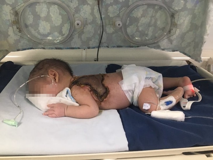 em be nhiem khuan